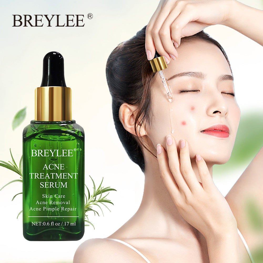 BREYLEE Acne Treatment Face Serum Mask Anti Acne Pimple Scar Remover Moisturizing Whitening Skin Care Facial Essence Cream 17ml